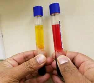 PRP samples