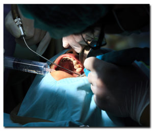 PRP Applications in dental medicine.