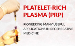 Platelet-Rich Plasma