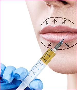 PRP-filler-injections